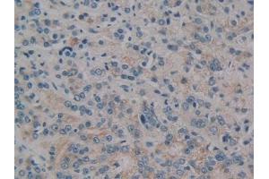 Immunohistochemistry (IHC) image for anti-Polycystic Kidney Disease 1 (Autosomal Dominant) (PKD1) antibody (ABIN7442792)