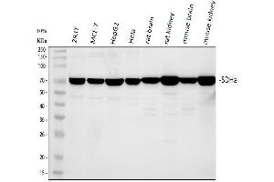 Western blot analysis of SDHA using anti-SDHA antibody (ABIN3043324).