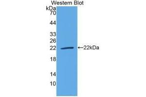 Western Blotting (WB) image for Interleukin 18 (IL18) ELISA Kit (ABIN6720553)