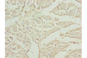 Immunohistochemistry of paraffin-embedded human heart tissue using ABIN7143358 at dilution of 1:100 (CAP2 抗体  (AA 221-477))