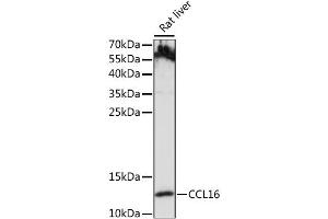 Western blot analysis of extracts of Rat liver, using CCL16 antibody (ABIN6291950) at 1:1000 dilution. (CCL16 抗体)