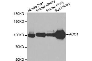 Western blot analysis of extracts of various cell lines, using ACO1 antibody (ABIN1877037) at 1:500 dilution. (Aconitase 1 抗体)