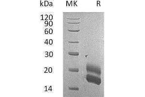 Western Blotting (WB) image for Colony Stimulating Factor 2 (Granulocyte-Macrophage) (CSF2) protein (His tag) (ABIN7321257)