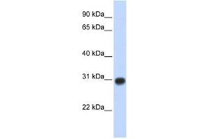 Western Blotting (WB) image for anti-Zinc Finger, MYND-Type Containing 19 (ZMYND19) (Middle Region) antibody (ABIN928445)