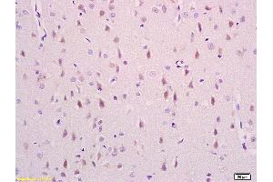 Formalin-fixed and paraffin embedded rat brain labeled with Anti phospho-NDEL1(Ser231) Polyclonal Antibody,Unconjugated (ABIN710801) at 1:200 followed by conjugation to the secondary antibody and DAB staining. (NDEL1 抗体  (pSer231))