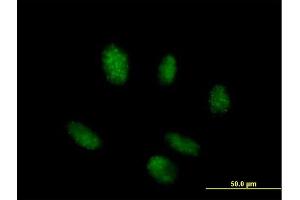 Immunofluorescence of purified MaxPab antibody to TINF2 on HeLa cell. (TINF2 抗体  (AA 1-451))