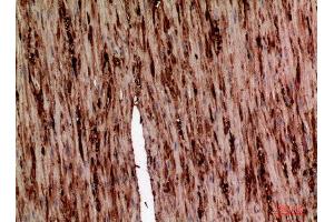 Immunohistochemistry (IHC) analysis of paraffin-embedded Human Colon, antibody was diluted at 1:100. (AAT (Internal Region) 抗体)