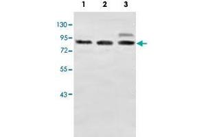 Western blot analysis of human fetal brain (Lane 1) and fetal lung (Lane 2) and fetal kidney (Lane 3) lysates with ZC3H11A polyclonal antibody  at 1 : 500 dilution. (ZC3H11A 抗体  (AA 332-585))