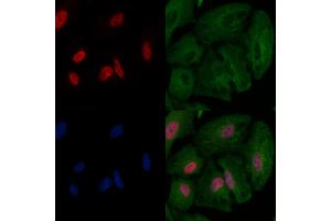 ABIN6263158 and ABIN6266586 staining  cells by IF/ICC. (MCM2 抗体  (N-Term))