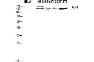 Western Blot (WB) analysis of HeLa KB SH-SY5Y 293T 3T3 lysis using Abl1 antibody. (ABL1 抗体  (Ser120, Ser121))