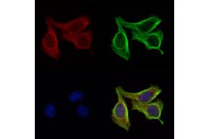 ABIN6264452 and ABIN6276642 staining Hela cells by IF/ICC. (PRSS1 抗体  (Internal Region))