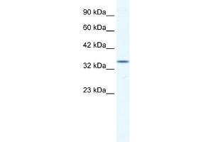 ZFP589 antibody (20R-1179) used at 0. (ZFP589 (Middle Region) 抗体)