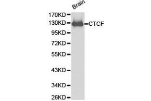 Western Blotting (WB) image for anti-CCCTC-Binding Factor (Zinc Finger Protein) (CTCF) antibody (ABIN1872063) (CTCF 抗体)