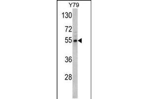 Western blot analysis of Fascin Antibody in Y79 cell line lysates (35ug/lane) (Fascin 抗体  (AA 322-350))