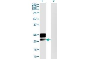 Western Blot analysis of DMRTB1 expression in transfected 293T cell line by DMRTB1 monoclonal antibody (M02), clone 5E7. (DMRTB1 抗体  (AA 1-189))