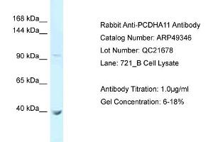 WB Suggested Anti-PCDHA11 Antibody   Titration: 1. (PCDHA11 抗体  (N-Term))