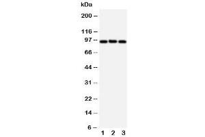 Western blot testing of ABCB6 antibody and Lane 1:  HeLa (ABCB6 抗体  (C-Term))