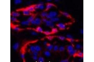 Immunofluorescence analysis of Human breast tissue using CK-17 Monoclonal Antibody at dilution of 1:200. (KRT17 抗体)