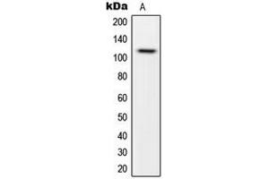 Western blot analysis of CARD14 expression in HeLa (A) whole cell lysates. (CARD14 抗体  (Center))