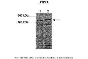Lanes:   Lane1: 40 ug mouse endothelial firboblast lysate Lane2: 40 ug human HUVEC lysate  Primary Antibody Dilution:   1:500  Secondary Antibody:   Anti-rabbit HRP  Secondary Antibody Dilution:   1:2000  Gene Name:   ATP7A  Submitted by:   Anonymous