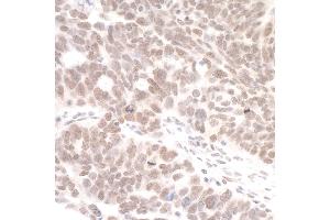 Immunohistochemistry (IHC) image for anti-DEAH (Asp-Glu-Ala-His) Box Polypeptide 8 (DHX8) (AA 325-375) antibody (ABIN7454652) (DHX8 抗体  (AA 325-375))