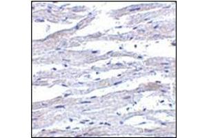 Immunohistochemistry of RIG-1 in human heart tissue with this product at 5 μg/ml. (DDX58 抗体)