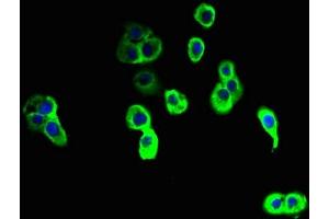 Immunofluorescent analysis of A431 cells using ABIN7161614 at dilution of 1:100 and Alexa Fluor 488-congugated AffiniPure Goat Anti-Rabbit IgG(H+L) (NINJ2 抗体  (AA 17-81))