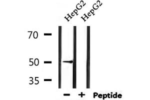 Western blot analysis of extracts from HepG2, using HTR3D Antibody. (HTR3D 抗体)