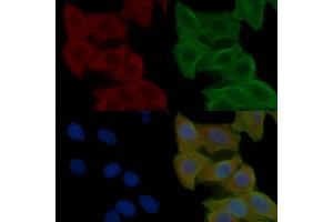 ABIN6258546 and ABIN6275024 staining Hela cells(24h of starvation treatment) by IF/ICC. (CCDC102A 抗体  (Internal Region))