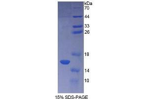 SDS-PAGE analysis of Human CF6 Protein. (ATP5J 蛋白)