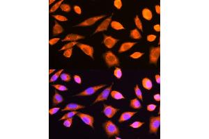 Immunofluorescence analysis of L929 cells using RPS20 antibody (ABIN6129112, ABIN6147211, ABIN6147212 and ABIN6214592) at dilution of 1:100. (RPS20 抗体  (AA 1-119))