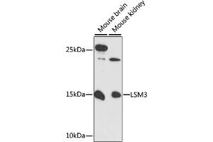 Western blot analysis of extracts of various cell lines, using LSM3 antibody (ABIN6131052, ABIN6143360, ABIN6143361 and ABIN6217093) at 1:3000 dilution. (LSM3 抗体  (AA 1-102))