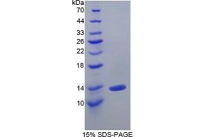 SDS-PAGE analysis of Human IL10Ra Protein. (IL-10RA 蛋白)