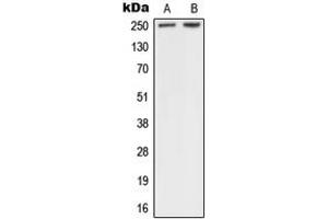 Western blot analysis of NF1 expression in A431 (A), HeLa (B) whole cell lysates. (Neurofibromin 1 抗体  (Center))