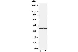 Western blot testing of IGFBP1 antibody and Lane 1:  SMMC-7721;  2: MCF-7 cell lysate (IGFBPI 抗体  (Middle Region))