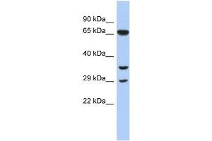 WB Suggested Anti-RYBP Antibody Titration:  0. (RYBP 抗体  (N-Term))