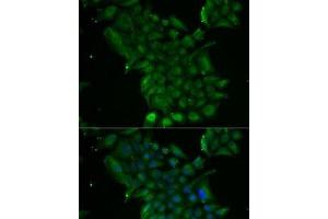 Immunofluorescence analysis of MCF7 cells using TCN1 Polyclonal Antibody (TCN1 抗体)