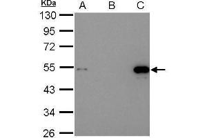 Immunoprecipitation (IP) image for anti-Tumor Protein P53 (TP53) antibody (ABIN2855525)