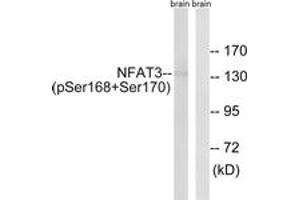 Western Blotting (WB) image for anti-Nuclear Factor of Activated T-Cells, Cytoplasmic, Calcineurin-Dependent 4 (NFATC4) (AA 136-185), (pSer168) antibody (ABIN482772) (NFATC4 抗体  (pSer168))