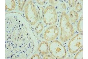 Immunohistochemistry of paraffin-embedded human kidney tissue using ABIN7167058 at dilution of 1:100 (RSAD2 抗体  (AA 42-361))