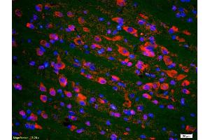 Immunofluorescence (IF) image for anti-Tumor Protein P53 (TP53) (pSer20) antibody (ABIN702895)