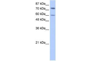 IGF2BP1 antibody used at 0. (IGF2BP1 抗体  (N-Term))