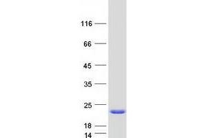 Western Blotting (WB) image for ADP-Ribosylation Factor 1 (ARF1) (Transcript Variant 4) protein (Myc-DYKDDDDK Tag) (ABIN2714425)