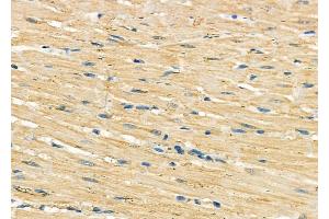 ABIN6262032 and ABIN6278985 at 1/100 staining Rat heart tissue by IHC-P. (GOLT1B 抗体  (C-Term))
