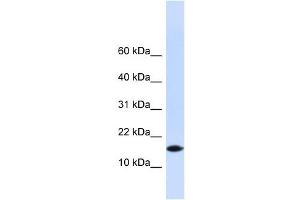 PHLDA3 antibody used at 1 ug/ml to detect target protein. (PHLDA3 抗体  (N-Term))