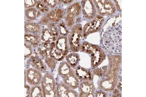 Immunohistochemical staining of human kidney with KCTD14 polyclonal antibody  shows strong cytoplasmic positivity in cells in tubules. (KCTD14 抗体)