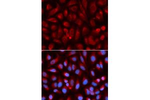 Immunofluorescence analysis of U2OS cells using ADA antibody. (ADA 抗体)