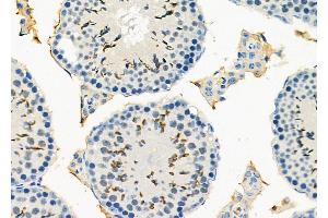 ABIN6266305 and ABIN6277424 at 1/100 staining Mouse testis tissue by IHC-P.