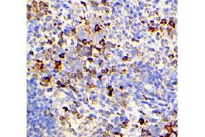 ABIN6276358 at 1/200 staining mouse spleen tissue sections by IHC-P. (IL-6 抗体  (Internal Region))