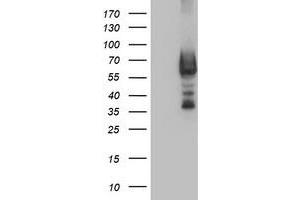 Western Blotting (WB) image for anti-Dystrobrevin, beta (DTNB) antibody (ABIN1497916) (Dystrobrevin beta 抗体)